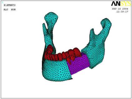 http://www.me.unm.edu/~khraishi/mandible_mesh.jpg