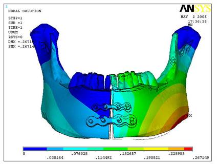 http://www.me.unm.edu/~khraishi/contoured_mandible.jpg