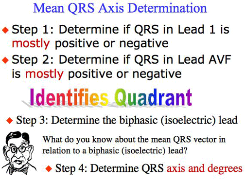 QRS Determination