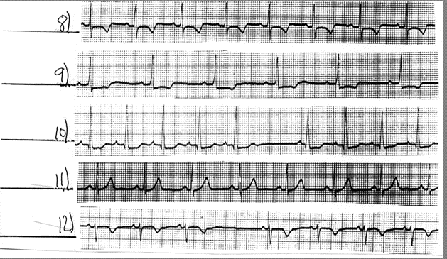 EKG Sept 14 - Sept 18