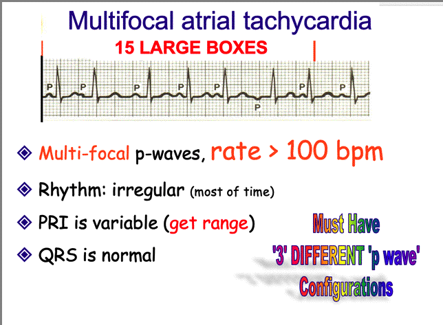 wandering atrial pacemaker vs mat